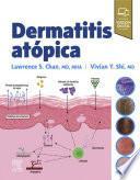 Dermatitis Atópica