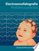 Libro Electroencefalografía Pediatría Práctica