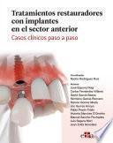 Tratamientos restauradores con implantes en el sector anterior. Casos clínicos paso a paso